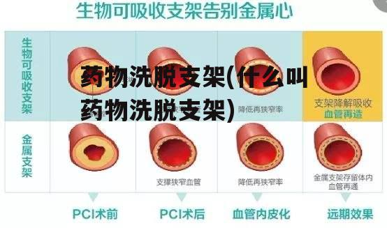 药物洗脱支架(什么叫药物洗脱支架)