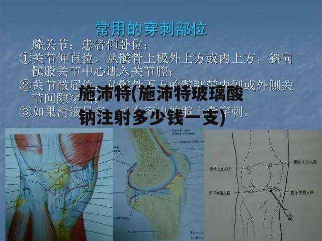 施沛特(施沛特玻璃酸钠注射多少钱一支)